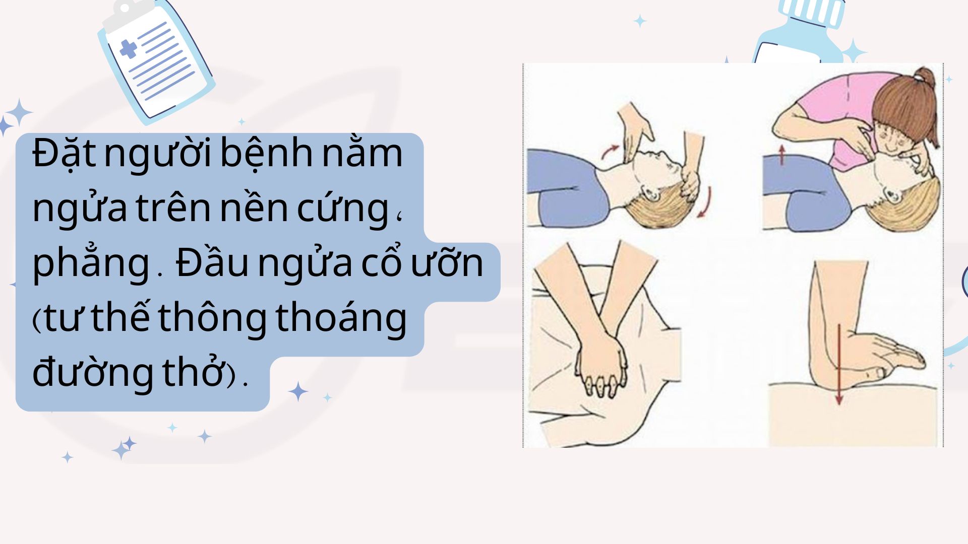 4. Điều cần làm khi sơ cứu cho người ngừng thở ngừng tim
